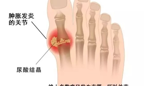 黄花木曼陀罗-黄花曼陀罗有什么功效网黄花曼陀罗有什么功效作用知识网站,分享黄花石蒜和曼陀罗华有什么区别大全